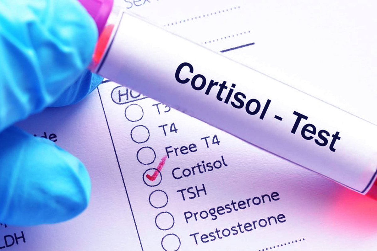 Зачем нужены анализы на кортизол